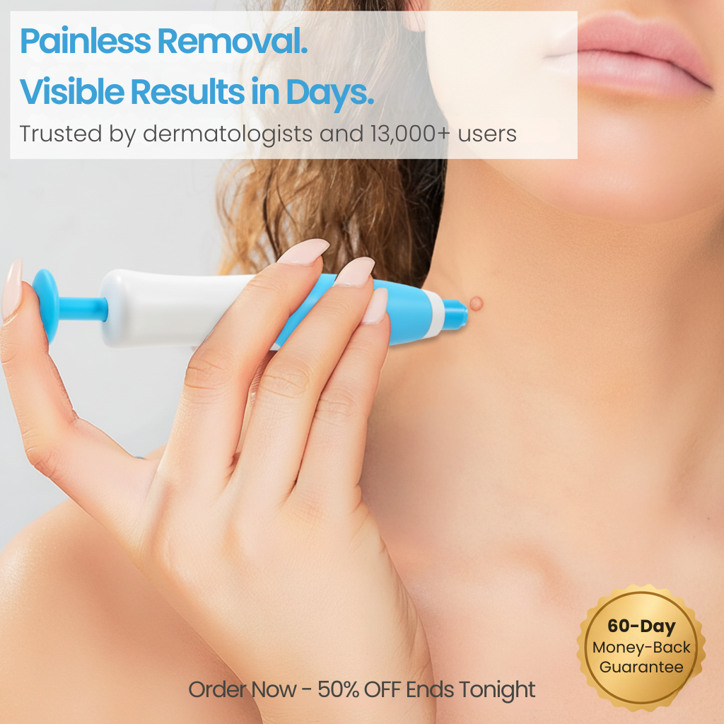 MyTag® Auto Wart Removal Kit [Clear Skin in 3 Days]