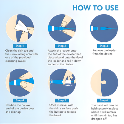 MyTag® Auto Wart Removal Kit [Clear Skin in 3 Days]